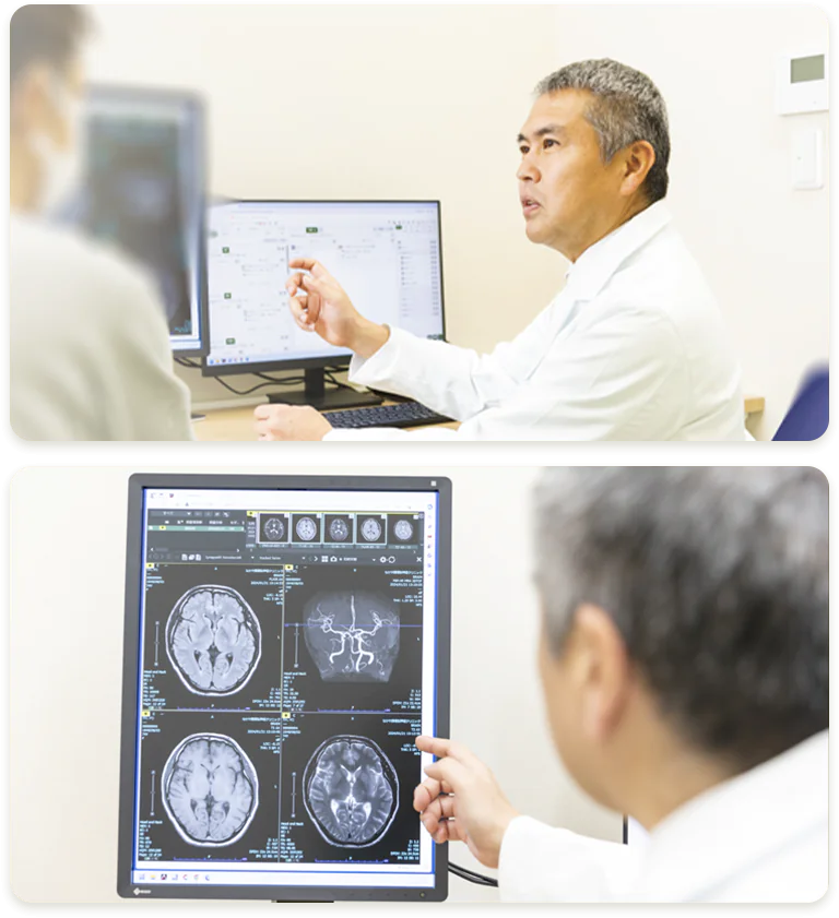 脳の健康診断 脳ドック